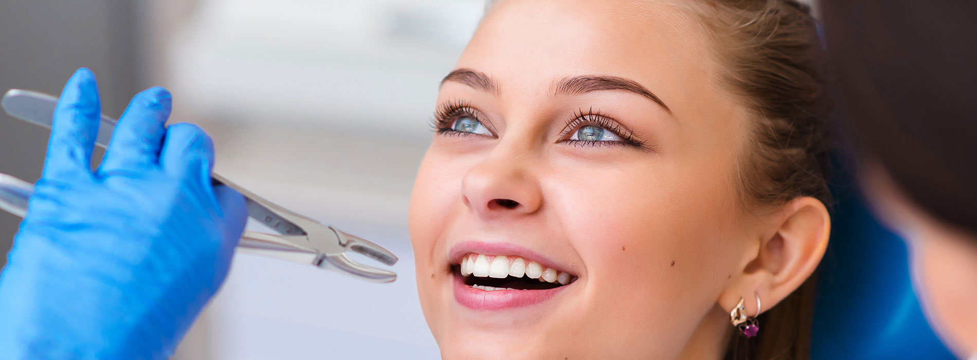 Teeth Extractions in Albuquerque